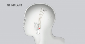 Neuralink 将于 11 月 30 日举办“Show & Tell”技术活动【EV棋牌】-EV棋牌